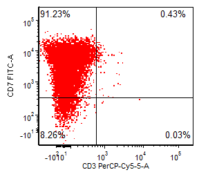 Figure 6b: Flow cytometry, peripheral blood. Blasts (red) are CD45+ (moderate), CD7+, CD11b+, CD34+, and CD117+ (partial). Surface CD3 is negative.